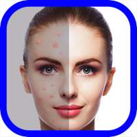 Face Blemish Eraser makeup on 9Apps