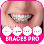 Top Braces Teeth :Photo Editor on 9Apps