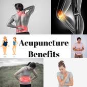 ACUPUNCTURE BENEFITS - ACHIEVING BETTER HEALTH on 9Apps