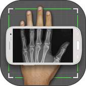 X-ray Scanner Prank on 9Apps