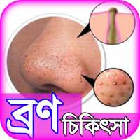 bron dur korar upay or tips ~ ব্রণ দূর করার উপায় on 9Apps