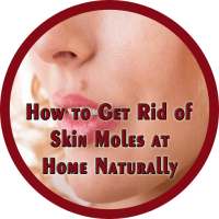 How to Get Rid of Skin Moles at Home Naturally on 9Apps