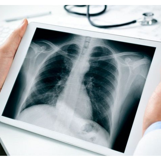 X-ray Interpretation for Medical Use Update icon