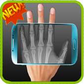 X-Ray Human Scan prank on 9Apps