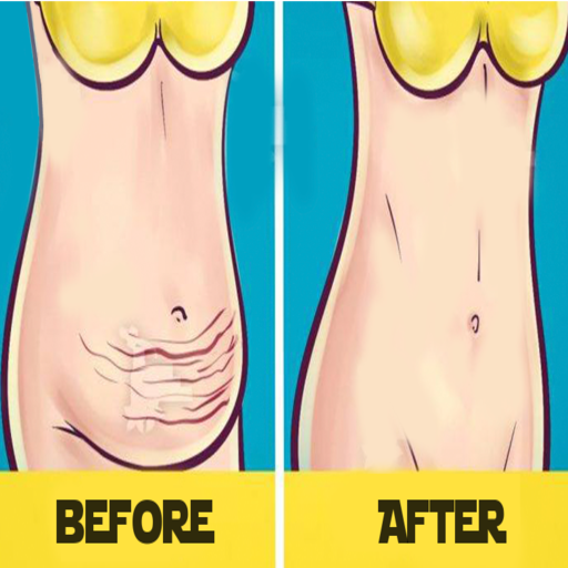 تخسيس وشد الترهلات 2020 أيقونة