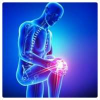 Osteoarthritis on 9Apps