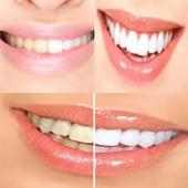 Whitening Teeth Tips on 9Apps