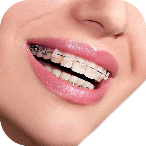 Real Braces Camera आइकन