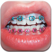 Real Braces Booth HD Studio icon