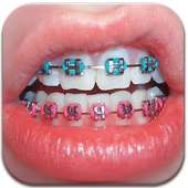 Real Braces Booth HD Studio