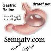 ( بالون المعده )  Gastric Balloon on 9Apps