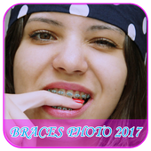 Braces Photos icon