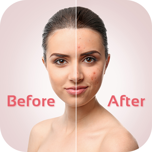 face blemishes removal-Smooth Skin &amp; Beautify Face icon