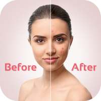 face blemishes removal-Smooth Skin & Beautify Face on 9Apps