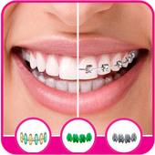 Braces Camera Editor icon