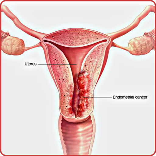 Vaginal Diseases &amp; Treatments icon