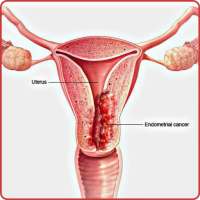 Vaginal Diseases & Treatments on 9Apps