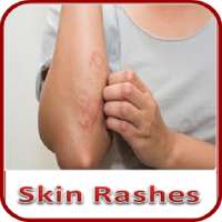 Skin Rashes on 9Apps