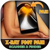 X-Ray Leg Pain Scanner Prank