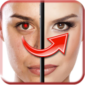 Red Eye Remover icon