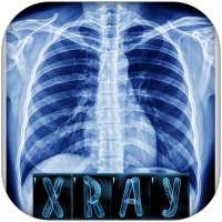 X Ray scanner interpretaion