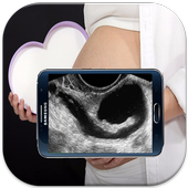 Scanner Pregnant X-ray Prank icon