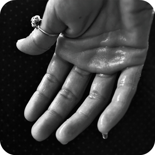 Excessive Sweating Treatment أيقونة