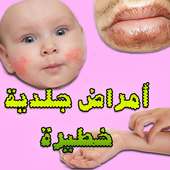 عندما يحذرك الجلد..علامات تدل على أمراض خطيرة on 9Apps