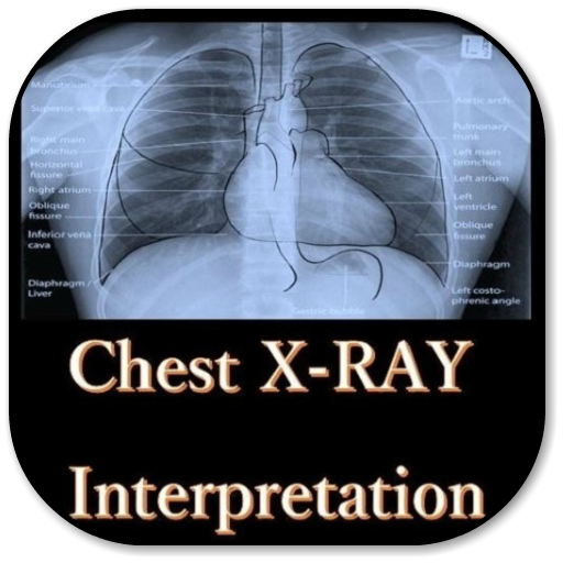 Chest X-Ray Interpretation - All in 1 icon