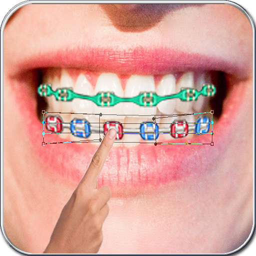 BracesTeeth Photo Editor icon