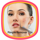 Pimple Remover Tips icon