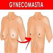 Gynecomastia ( Man Boobs ) on 9Apps