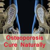 Osteoporosis cure on 9Apps