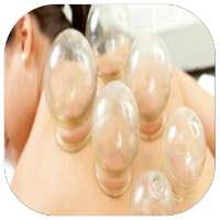 guide hijama on 9Apps