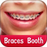 Braces Booth