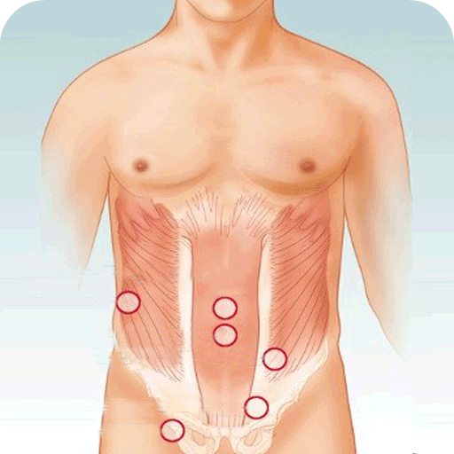 Hernia Home Remedies icon