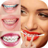 Brace Photo Fake icon