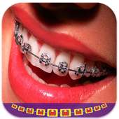 Real Braces Booth Photo Editor on 9Apps