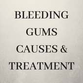 Bleeding Gums Causes on 9Apps