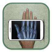 Mobile X-ray Scanner