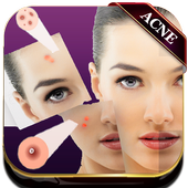 Acne Remover Photo Editor - Pimple remover icon