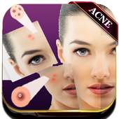 Acne Remover Photo Editor - Pimple remover