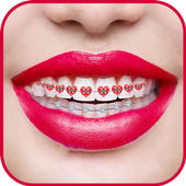 Braces Photo Editor icon