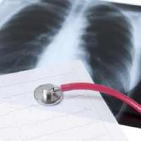 Clinical Chest Radiology on 9Apps