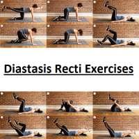 Diastasis Recti Exercises on 9Apps