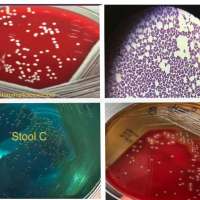 Microbiology quiz; plate reading app.