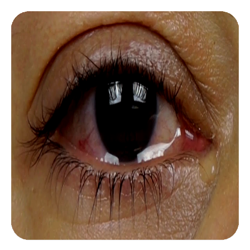 Watery Eyes (Guide) icon