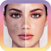 Cactus Photo Blemish editor icon