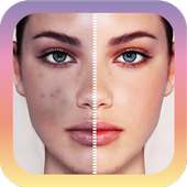 Editor de Cactus Foto Blemish on 9Apps