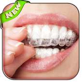 teeth whitening secrets tips on 9Apps